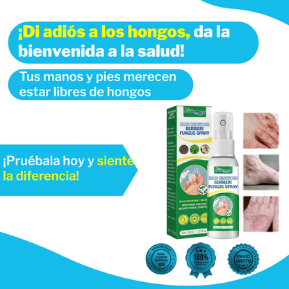 Tratamiento de Hongos manos y pies