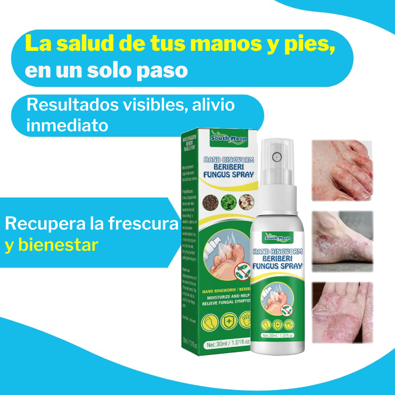 Tratamiento de Hongos manos y pies